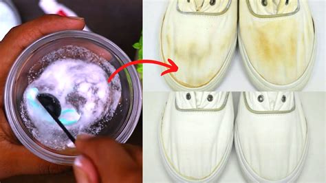 stain remover for white shoes.